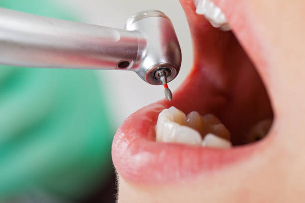 Best Dental Abscess Treatment in Williamsburg, PA